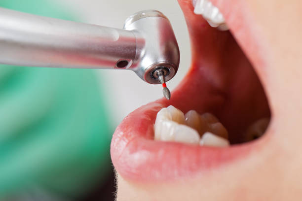 Best Emergency Dental Care for Sports Injuries in Pleasant Hill, TX